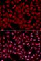 E3 ubiquitin-protein ligase SIAH1 antibody, orb136303, Biorbyt, Immunofluorescence image 