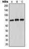 Myristoylated Alanine Rich Protein Kinase C Substrate antibody, MBS820442, MyBioSource, Western Blot image 