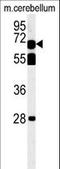 TBK1 Binding Protein 1 antibody, LS-C161744, Lifespan Biosciences, Western Blot image 