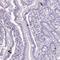 Zinc Finger Protein 334 antibody, NBP2-13567, Novus Biologicals, Immunohistochemistry paraffin image 