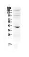 Insulin Like Growth Factor Binding Protein 3 antibody, PA5-79452, Invitrogen Antibodies, Western Blot image 