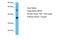 Solute Carrier Family 25 Member 3 antibody, A08076, Boster Biological Technology, Western Blot image 