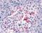 Respiratory Syncytial Virus antibody, PA1-23413, Invitrogen Antibodies, Immunohistochemistry paraffin image 