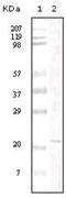 Protein Tyrosine Kinase 2 antibody, abx011975, Abbexa, Enzyme Linked Immunosorbent Assay image 