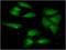 Aldehyde Dehydrogenase 2 Family Member antibody, GTX57696, GeneTex, Immunocytochemistry image 