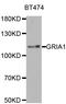 GluA1 antibody, LS-C335189, Lifespan Biosciences, Western Blot image 