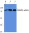 Myristoylated Alanine Rich Protein Kinase C Substrate antibody, A04133S163, Boster Biological Technology, Western Blot image 