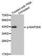 Mitogen-Activated Protein Kinase Kinase 6 antibody, MBS128549, MyBioSource, Western Blot image 