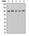 ADAM Metallopeptidase Domain 9 antibody, orb377899, Biorbyt, Western Blot image 