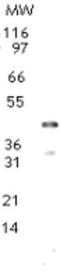 TRNA Aspartic Acid Methyltransferase 1 antibody, GTX13892, GeneTex, Western Blot image 