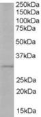 TIR Domain Containing Adaptor Protein antibody, EB05187, Everest Biotech, Western Blot image 
