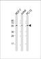 AKT Serine/Threonine Kinase 2 antibody, MBS9216873, MyBioSource, Western Blot image 