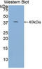 Trefoil Factor 3 antibody, LS-B13929, Lifespan Biosciences, Western Blot image 