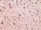 ETS Transcription Factor ELK1 antibody, 32-148, ProSci, Immunohistochemistry paraffin image 