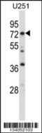 Radixin antibody, 57-426, ProSci, Western Blot image 