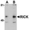 Receptor Interacting Serine/Threonine Kinase 2 antibody, GTX28427, GeneTex, Western Blot image 