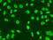 MutS Homolog 6 antibody, 13-352, ProSci, Immunofluorescence image 
