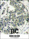 Eukaryotic Translation Initiation Factor 4E antibody, 60-600, ProSci, Immunohistochemistry paraffin image 
