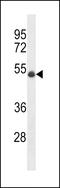 Ubiquitin Protein Ligase E3 Component N-Recognin 7 (Putative) antibody, 60-564, ProSci, Western Blot image 
