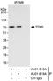 Tyrosyl-DNA Phosphodiesterase 1 antibody, A301-619A, Bethyl Labs, Immunoprecipitation image 