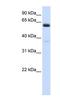 ALG6 Alpha-1,3-Glucosyltransferase antibody, NBP1-62495, Novus Biologicals, Western Blot image 