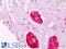 Crystallin Alpha B antibody, LS-B8412, Lifespan Biosciences, Immunohistochemistry paraffin image 