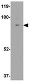 Hyaluronan Mediated Motility Receptor antibody, GTX31428, GeneTex, Western Blot image 