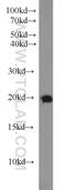 Ras-related protein Rab-18 antibody, 11304-1-AP, Proteintech Group, Western Blot image 