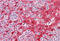 Cystatin A antibody, MBS247262, MyBioSource, Immunohistochemistry frozen image 