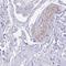 Family With Sequence Similarity 72 Member A antibody, NBP2-59790, Novus Biologicals, Immunohistochemistry paraffin image 