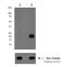 CD247 Molecule antibody, ab68236, Abcam, Western Blot image 