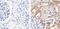 Mitogen-Activated Protein Kinase Kinase 1 antibody, GTX25612, GeneTex, Immunohistochemistry paraffin image 