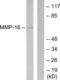 Matrix metalloproteinase-16 antibody, LS-C118523, Lifespan Biosciences, Western Blot image 