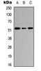 Cathepsin C antibody, MBS8218852, MyBioSource, Western Blot image 