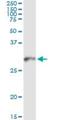 HLA class II histocompatibility antigen, DM beta chain antibody, H00003109-M08, Novus Biologicals, Immunoprecipitation image 