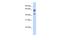 IGS11 antibody, A09664, Boster Biological Technology, Western Blot image 