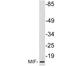 Macrophage Migration Inhibitory Factor antibody, LS-C199922, Lifespan Biosciences, Western Blot image 
