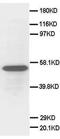 Secretogranin III antibody, PA5-79955, Invitrogen Antibodies, Western Blot image 