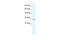 Purinergic Receptor P2X 7 antibody, 28-305, ProSci, Western Blot image 