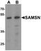 SAM Domain, SH3 Domain And Nuclear Localization Signals 1 antibody, A08977, Boster Biological Technology, Western Blot image 