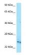 UMP-CMP kinase antibody, NBP1-98367, Novus Biologicals, Western Blot image 