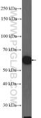 Karyopherin Subunit Alpha 6 antibody, 12366-2-AP, Proteintech Group, Western Blot image 