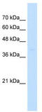 ST3 Beta-Galactoside Alpha-2,3-Sialyltransferase 3 antibody, TA339038, Origene, Western Blot image 