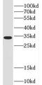 Peptidylprolyl Isomerase E antibody, FNab02139, FineTest, Western Blot image 