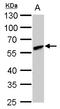 CLN3 Lysosomal/Endosomal Transmembrane Protein, Battenin antibody, GTX129457, GeneTex, Western Blot image 