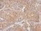 Phosphodiesterase 10A antibody, GTX118886, GeneTex, Immunohistochemistry paraffin image 