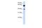 Dystrobrevin beta antibody, GTX46461, GeneTex, Western Blot image 