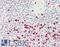 C-C Motif Chemokine Ligand 24 antibody, LS-C211298, Lifespan Biosciences, Immunohistochemistry paraffin image 