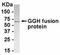 Gamma-Glutamyl Hydrolase antibody, NB100-75628, Novus Biologicals, Western Blot image 