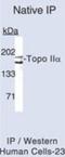 TOP2A antibody, NB110-5829, Novus Biologicals, Western Blot image 